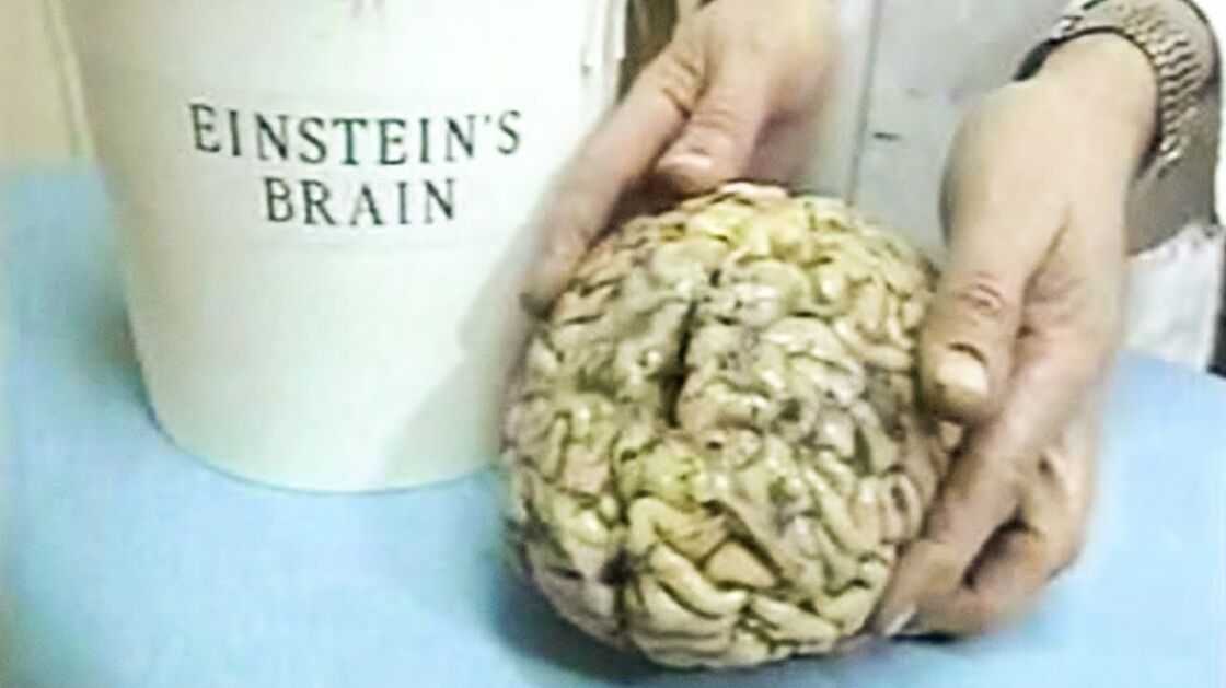 Einstein&#39;s Brain Was Stolen And Has Been In Weird Places Since His Death