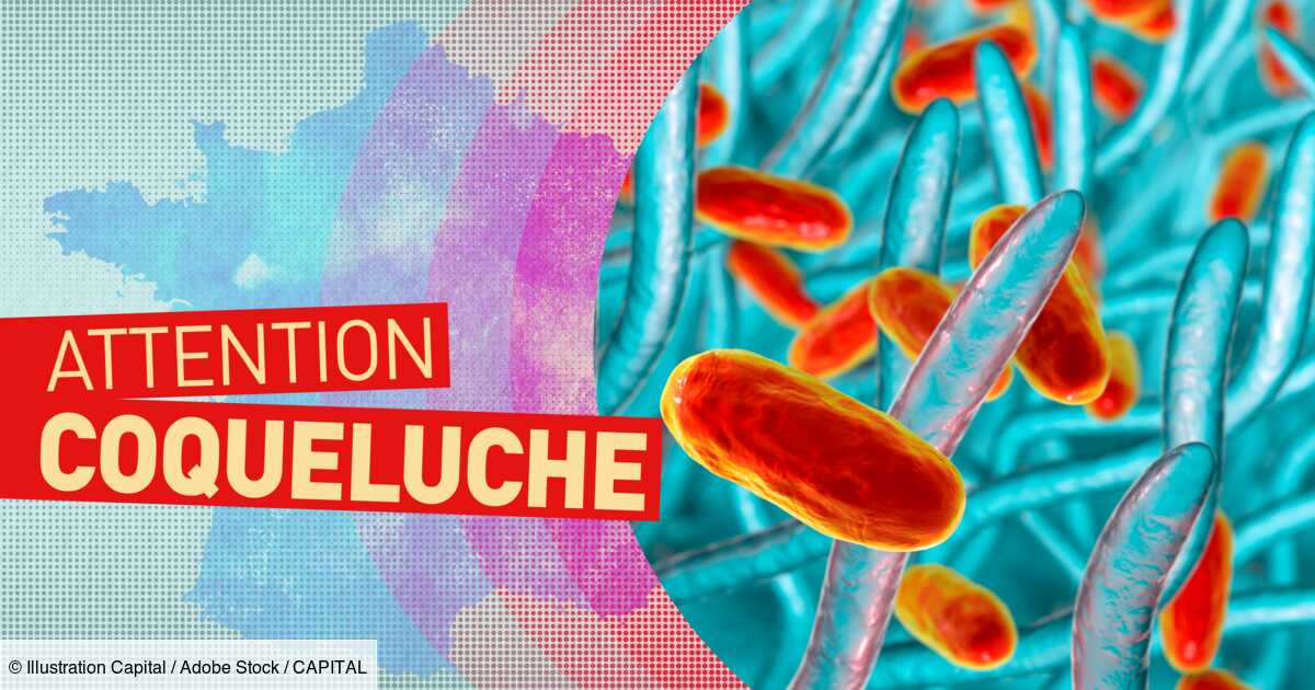 Epidémie : alerte sur l'explosion des cas de coqueluche en France