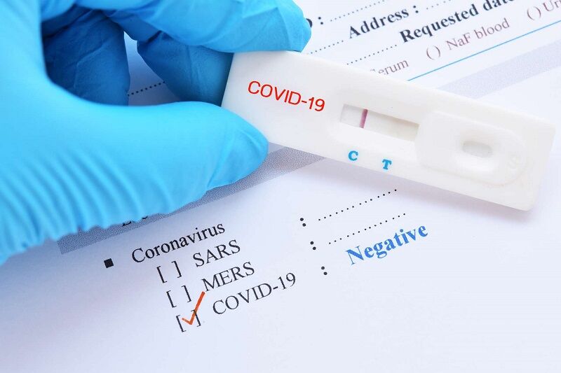 Covid-19 : les tests PCR payants pour les étrangers ? La ...