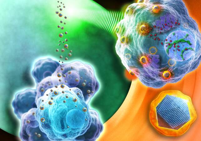 Nanobiotix, des nanoparticules pour mieux cibler les radiothérapies